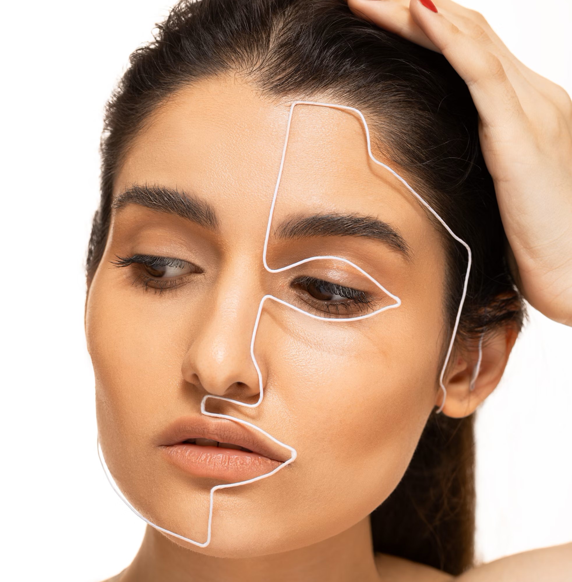 Meer over rosacea