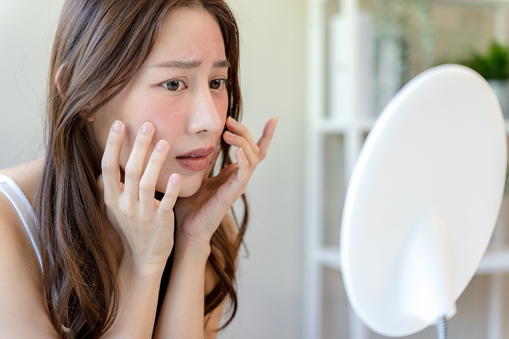 Rosacea behandelen: wat helpt ertegen?